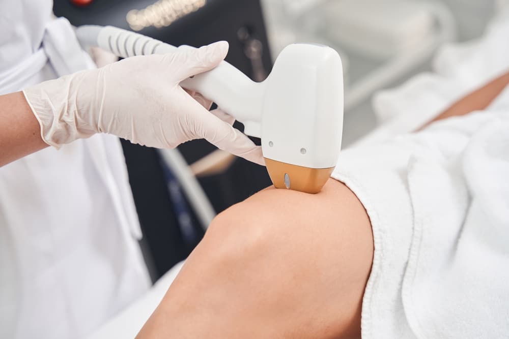 Épilation laser des jambes chez Clin’Epil à Marcq-en-Barœul