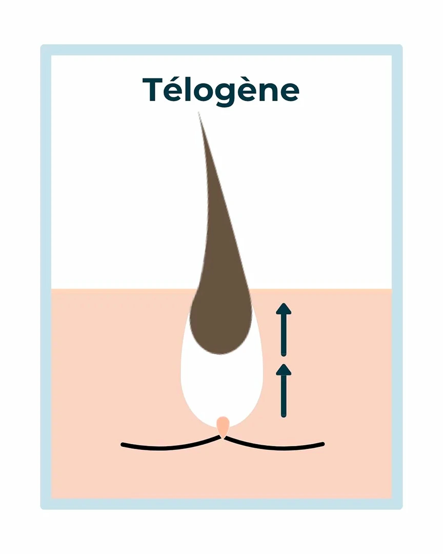 Schéma d'un poil en phase télogène : le poil, détaché de la papille, remonte vers la surface avant de tomber