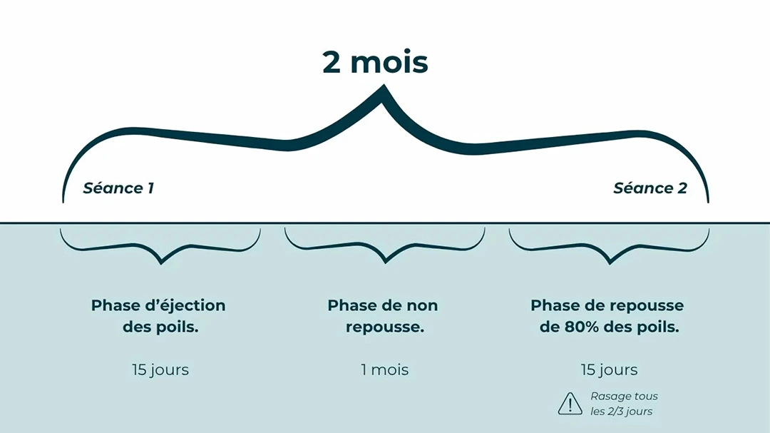 Chronologie des 2 mois entre deux séances d'épilation laser : éjection des poils, non-repousse, puis repousse