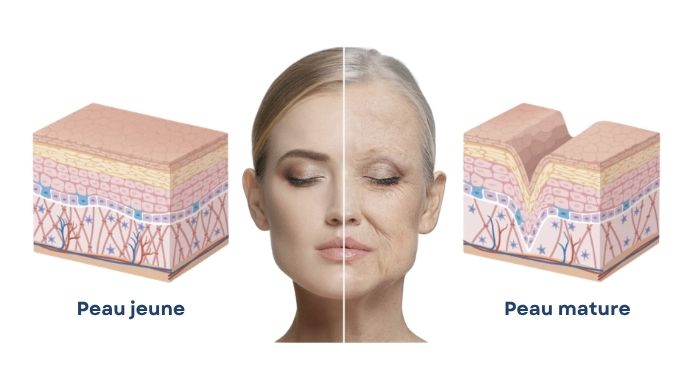 Comparaison peau jeune et peau mature : coupe de la peau montrant la perte de collagène et l'apparition des rides avec l'âge