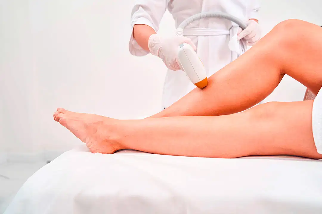 Séance d’épilation définitive au laser sur les jambe réalisée par une praticienne diplômée chez Clin’Epil.